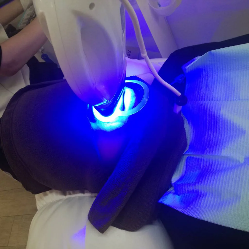 LEDライトの照射を受ける