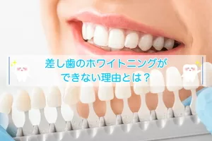 差し歯のホワイトニングができない理由とは？対処法と併せて解説