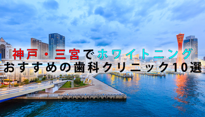 神戸・三宮でホワイトニングにおすすめの歯科クリニック10選【2021年版】