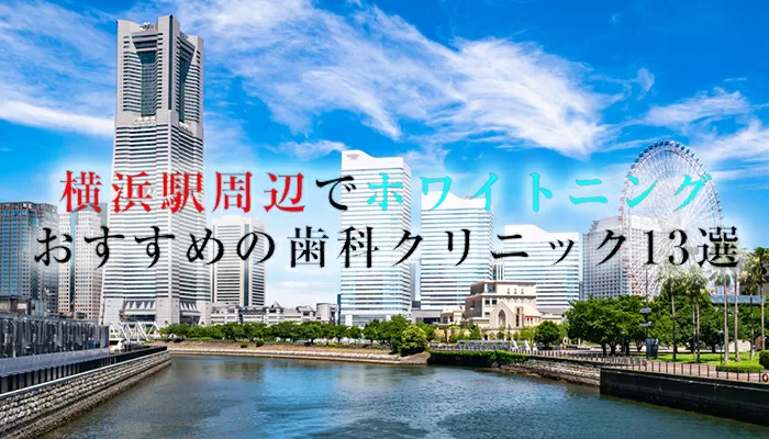 横浜でホワイトニングにおすすめの歯科クリニック13選