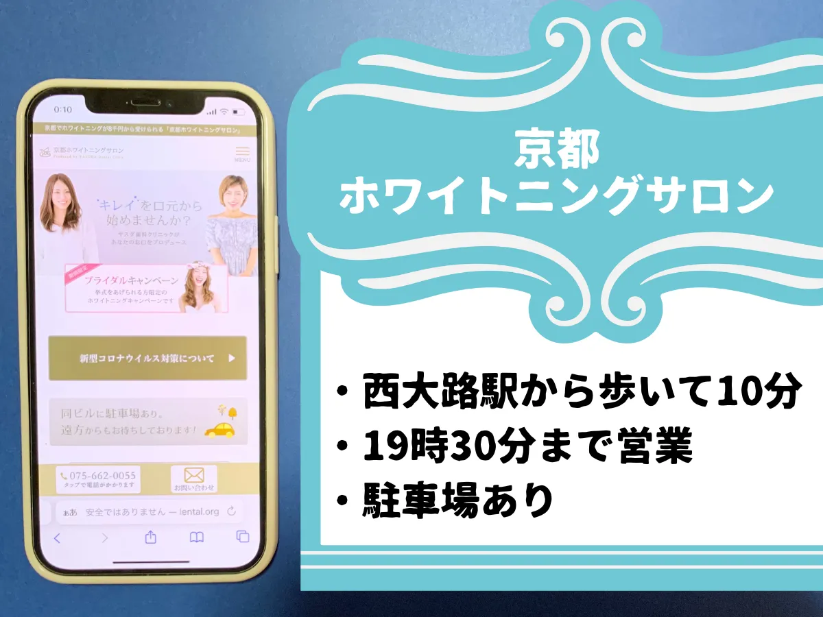 京都ホワイトニングサロン (ヤスダ歯科クリニック)のおすすめポイント