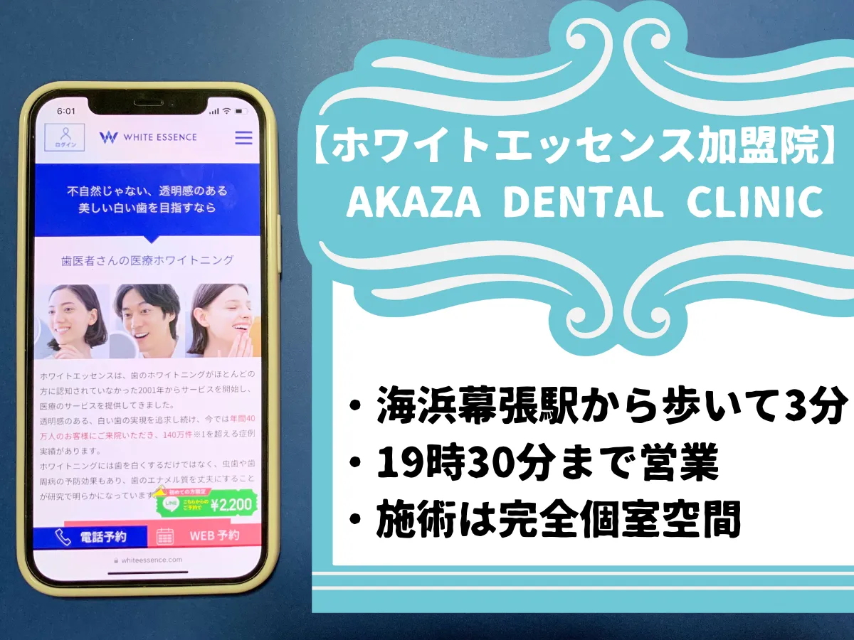 【ホワイトエッセンス加盟院】 AKAZA DENTAL CLINICのおすすめポイント