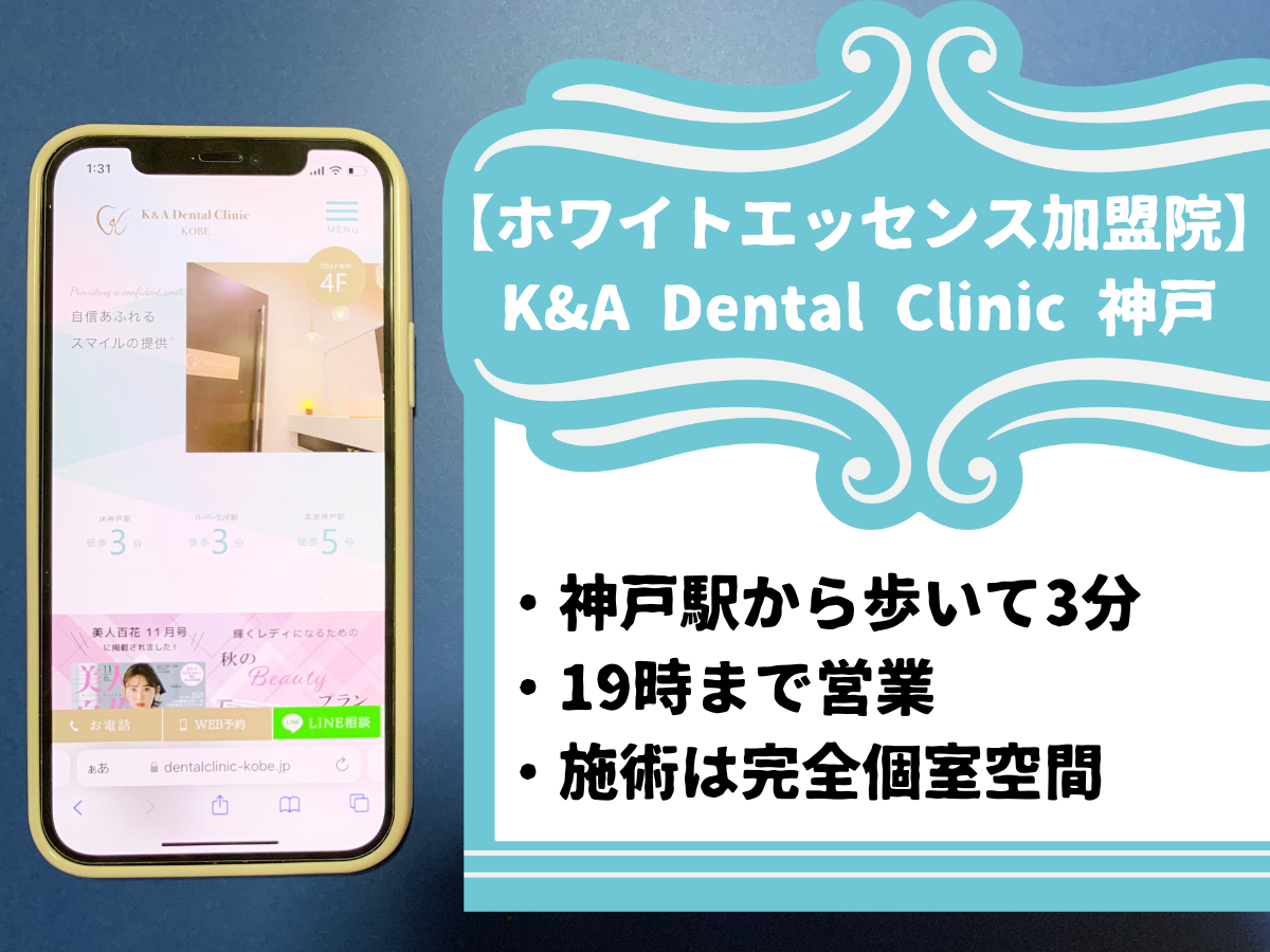 【ホワイトエッセンス加盟院】K&A Dental Clinic 神戸のおすすめポイント