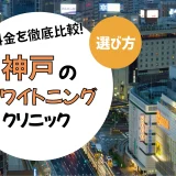 【神戸】ホワイトニングのおすすめクリニック10選！安い・上手いのは？名医・口コミなど選び方