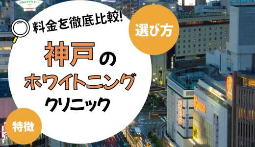 【神戸】ホワイトニングが安いおすすめ歯科医院10選