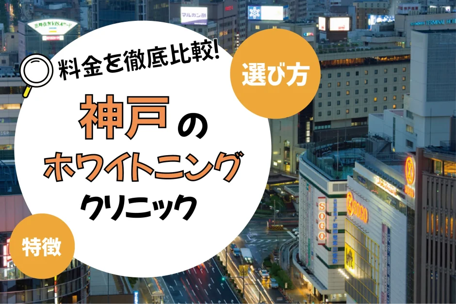 【神戸】ホワイトニングのおすすめクリニック10選！安い・上手いのは？名医・口コミなど選び方