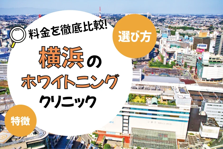 【横浜】ホワイトニングのおすすめクリニック10選！安い・上手いのは？名医・口コミなど選び方