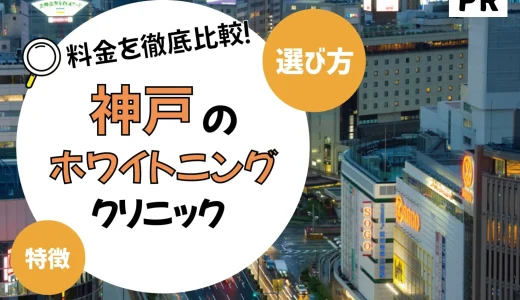 【神戸】ホワイトニングが安いおすすめ歯科医院10選